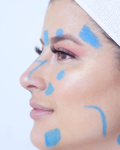 ARMONIZACION-FACIAL-RIONEGRO